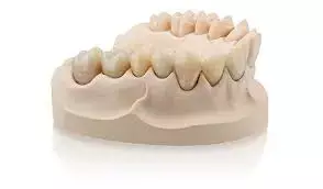 Maxillary overdentures supported by four or six anteriorly placed implants alleviate  persistent maxillary denture complaints