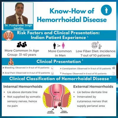 Infographic: Know-how of Hemorrhoidal Disease