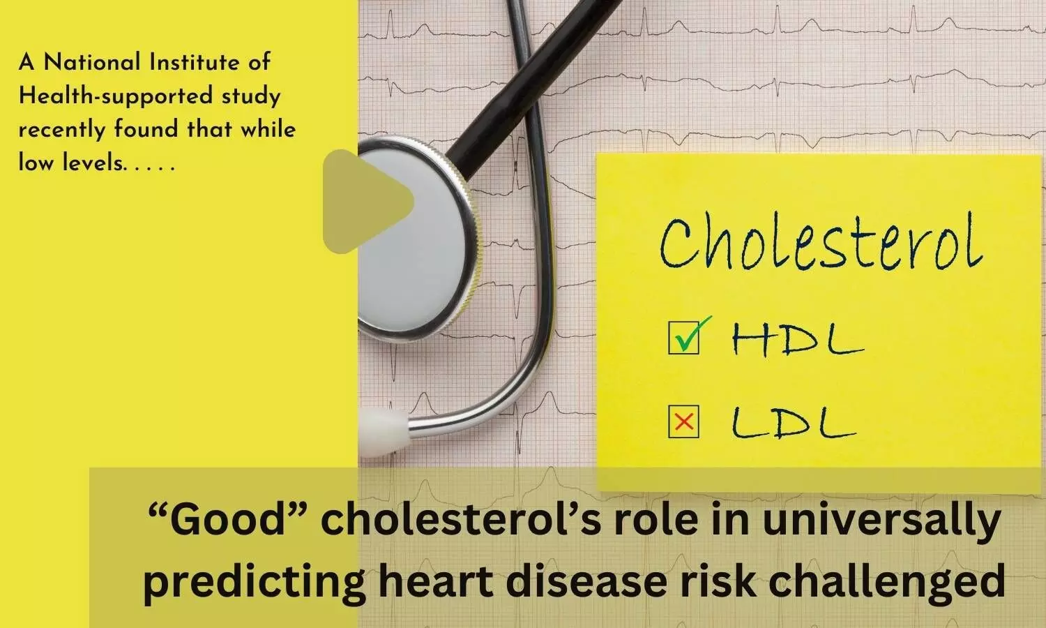 Good cholesterols role in universally predicting heart disease risk challenged
