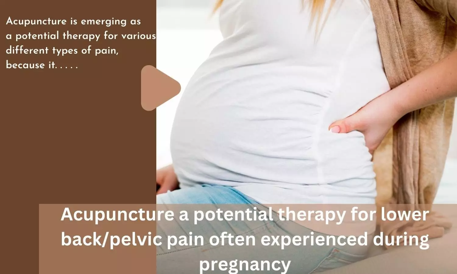 Acupuncture a potential therapy for lower back/pelvic pain often experienced during pregnancy