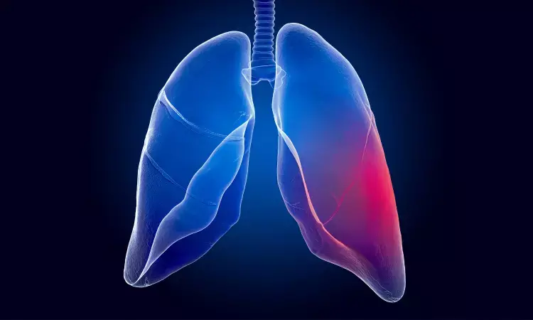 Higher bicarbonate excretion in cystic fibrosis predicts better lung function and pancreatic sufficiency