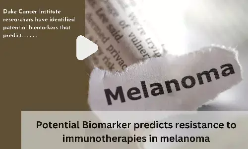 Potential Biomarker predicts resistance to immunotherapies in melanoma