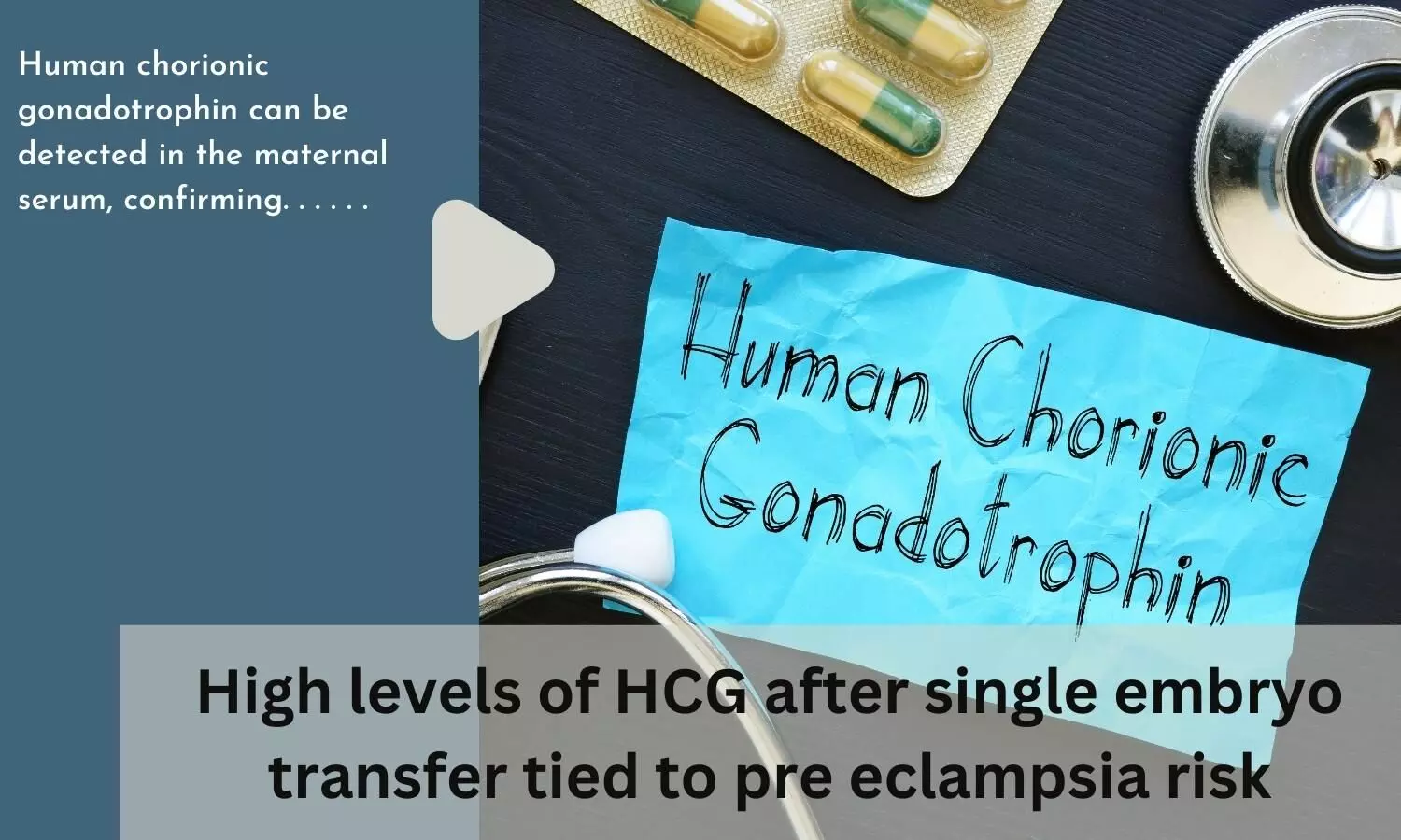 High levels of HCG after single embryo transfer tied to pre eclampsia risk