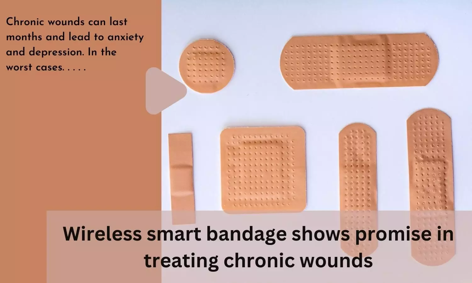 Wireless smart bandage shows promise in treating chronic wounds