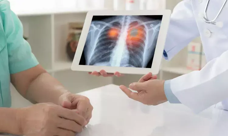 More frequent CT scans not associated with improved outcomes after lung cancer surgery