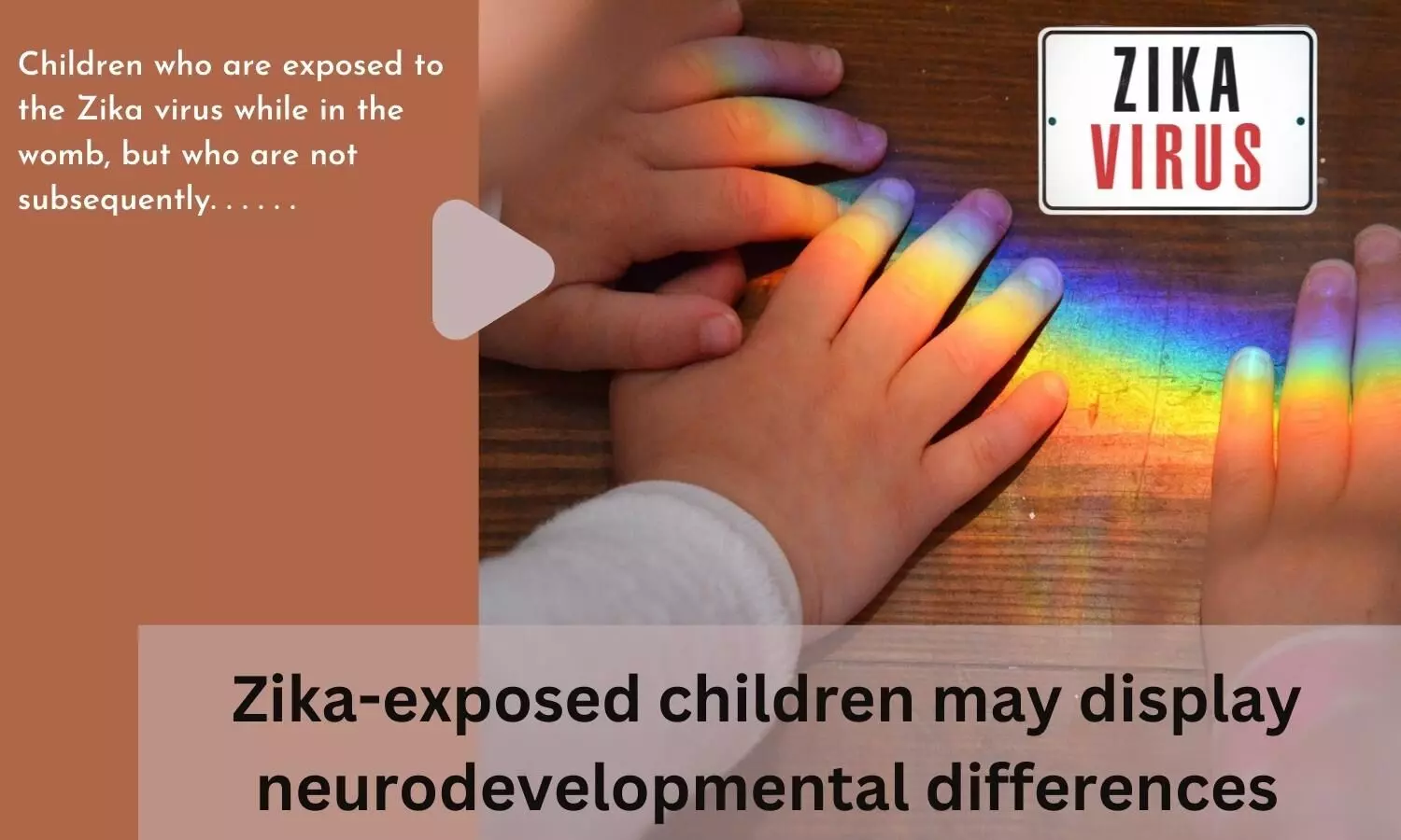 Zika-exposed children may display neurodevelopmental differences