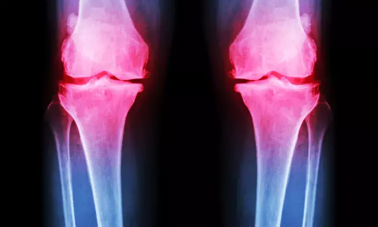 Antidepressants may relieve pain in knee osteoarthritis, but with CAUTION, research suggests