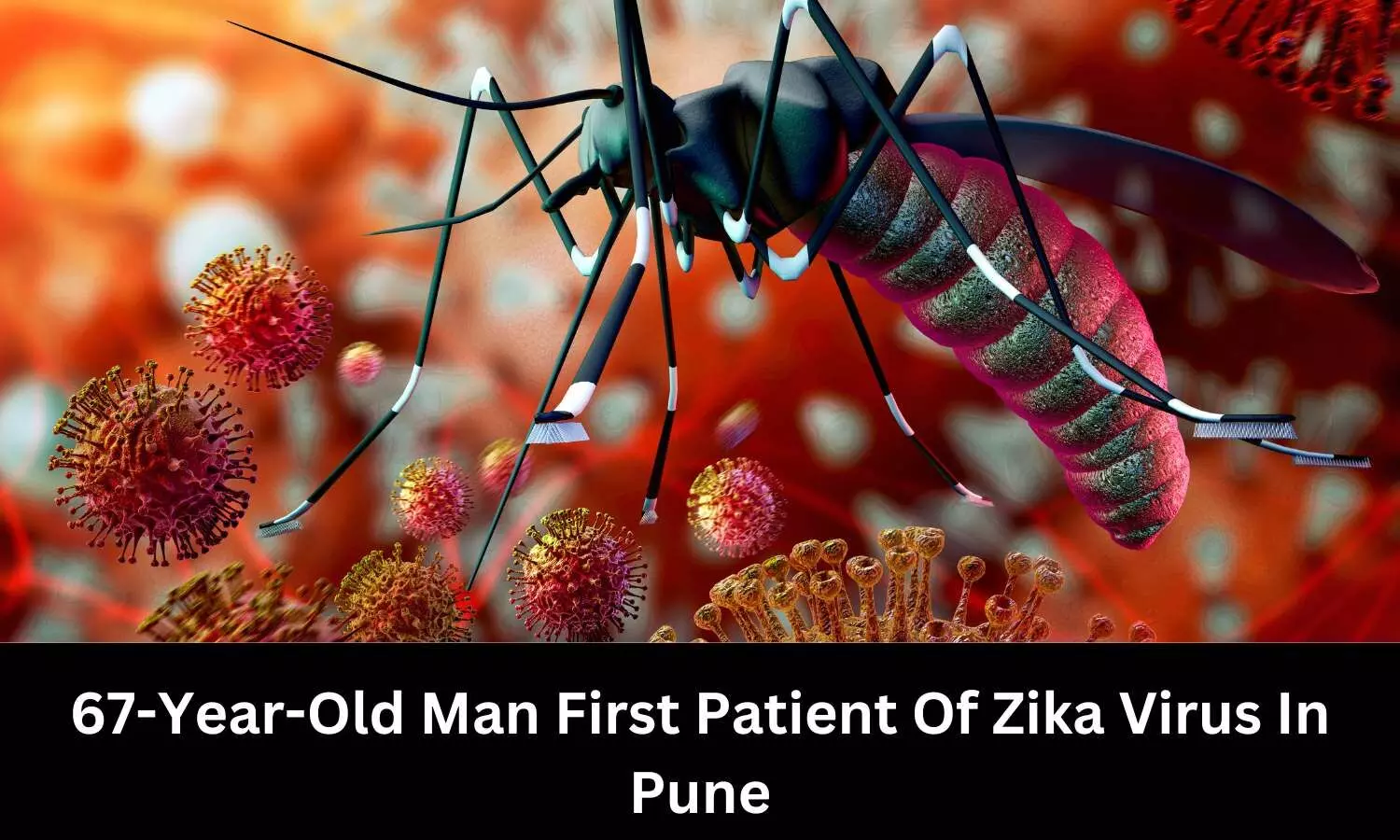 First case Zika virus detected in Pune