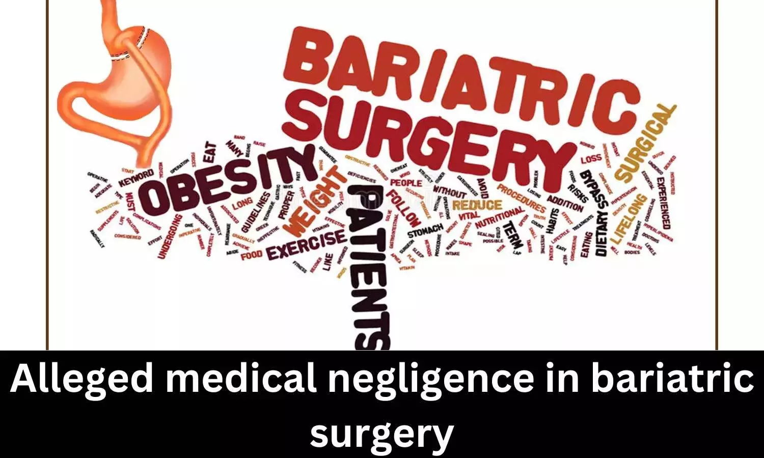 Alleged medical negligence in Bariatric surgery: NCDRC exonerates Chennai hospital, doctor