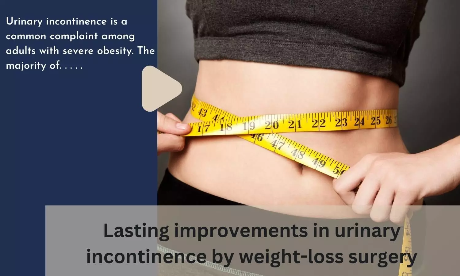 Lasting improvements in urinary incontinence by weight-loss surgery