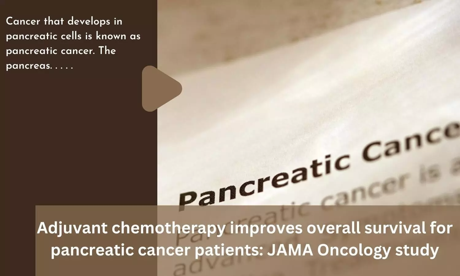 Adjuvant chemotherapy improves overall survival for pancreatic cancer patients: JAMA Oncology study
