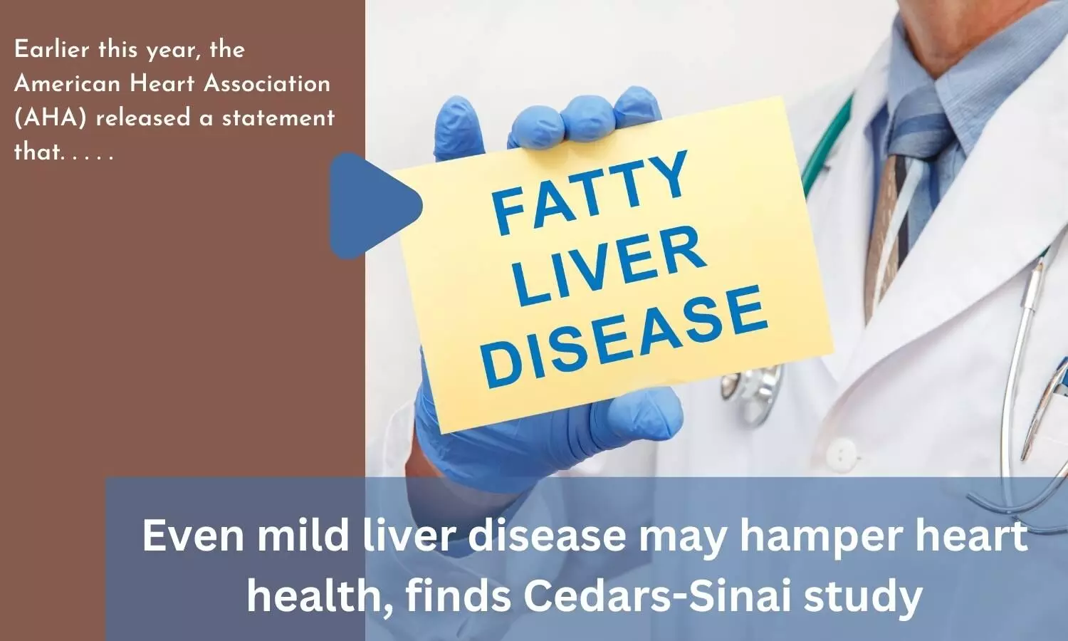 Even mild liver disease may hamper heart health, finds Cedars-Sinai study