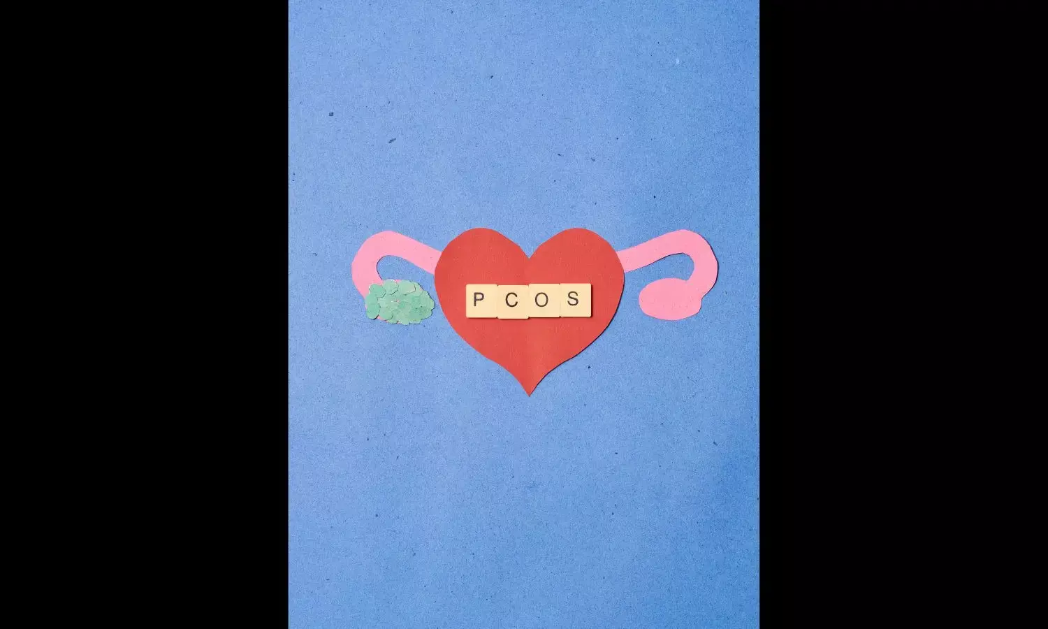 5 Celebrities Suffering From PCOS