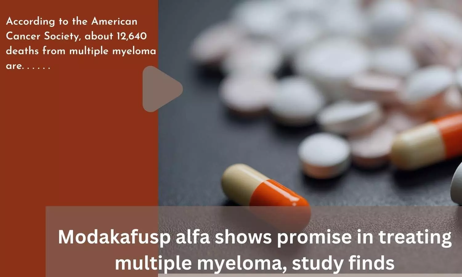 Modakafusp alfa shows promise in treating multiple myeloma, study finds