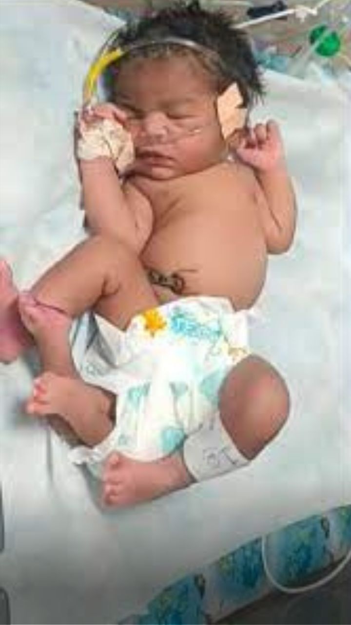 Baby With 4 Legs Born In Madhya Pradesh