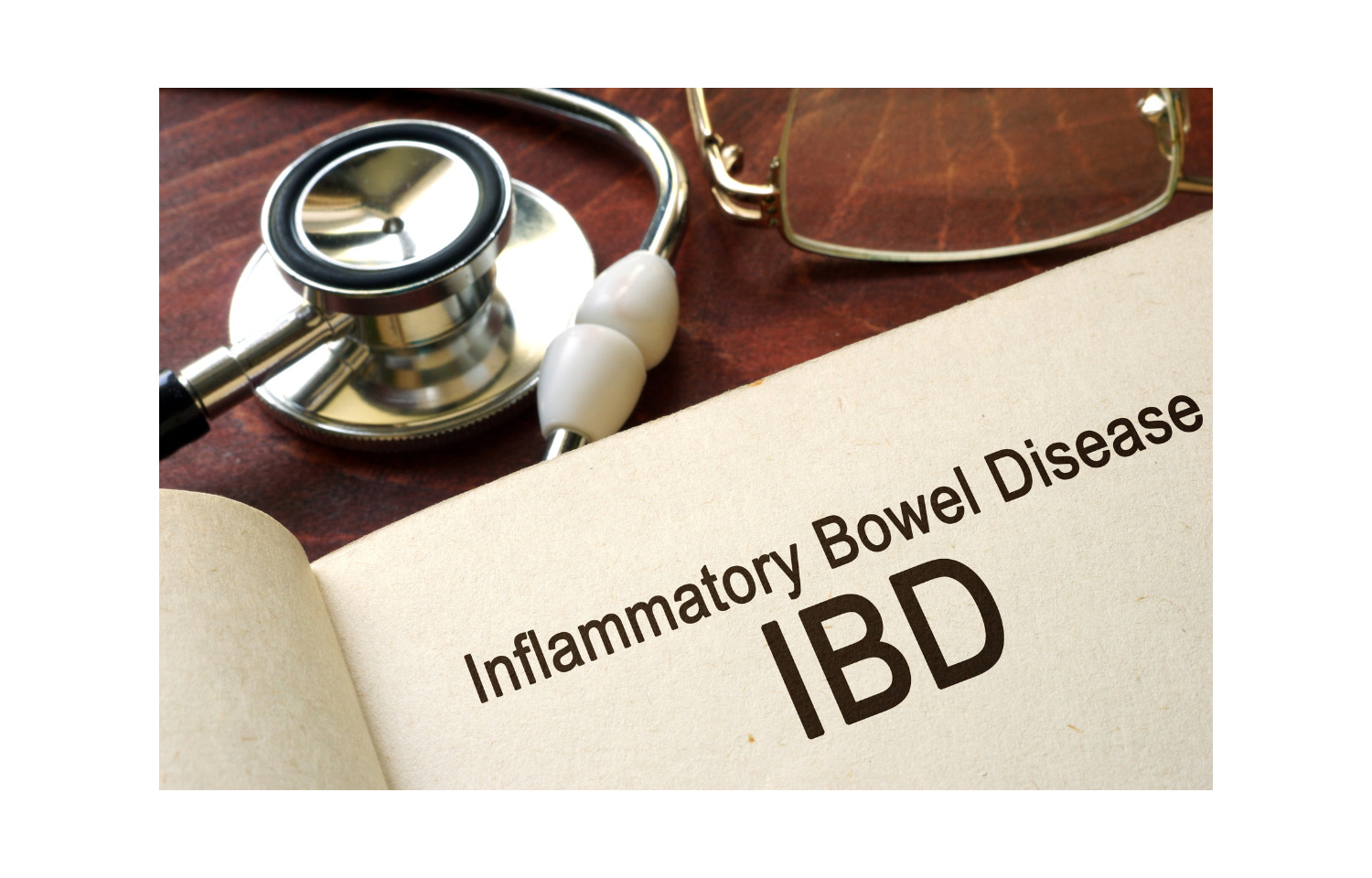 biologics-may-lower-risk-of-advanced-stage-ibd-associated-intestinal-cancer