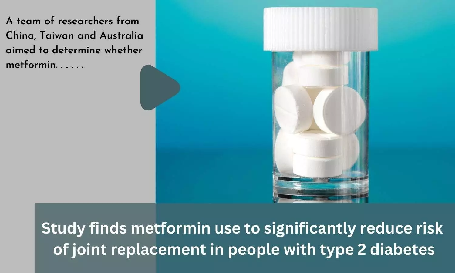Study finds metformin use to significantly reduce risk of joint replacement in people with type 2 diabetes