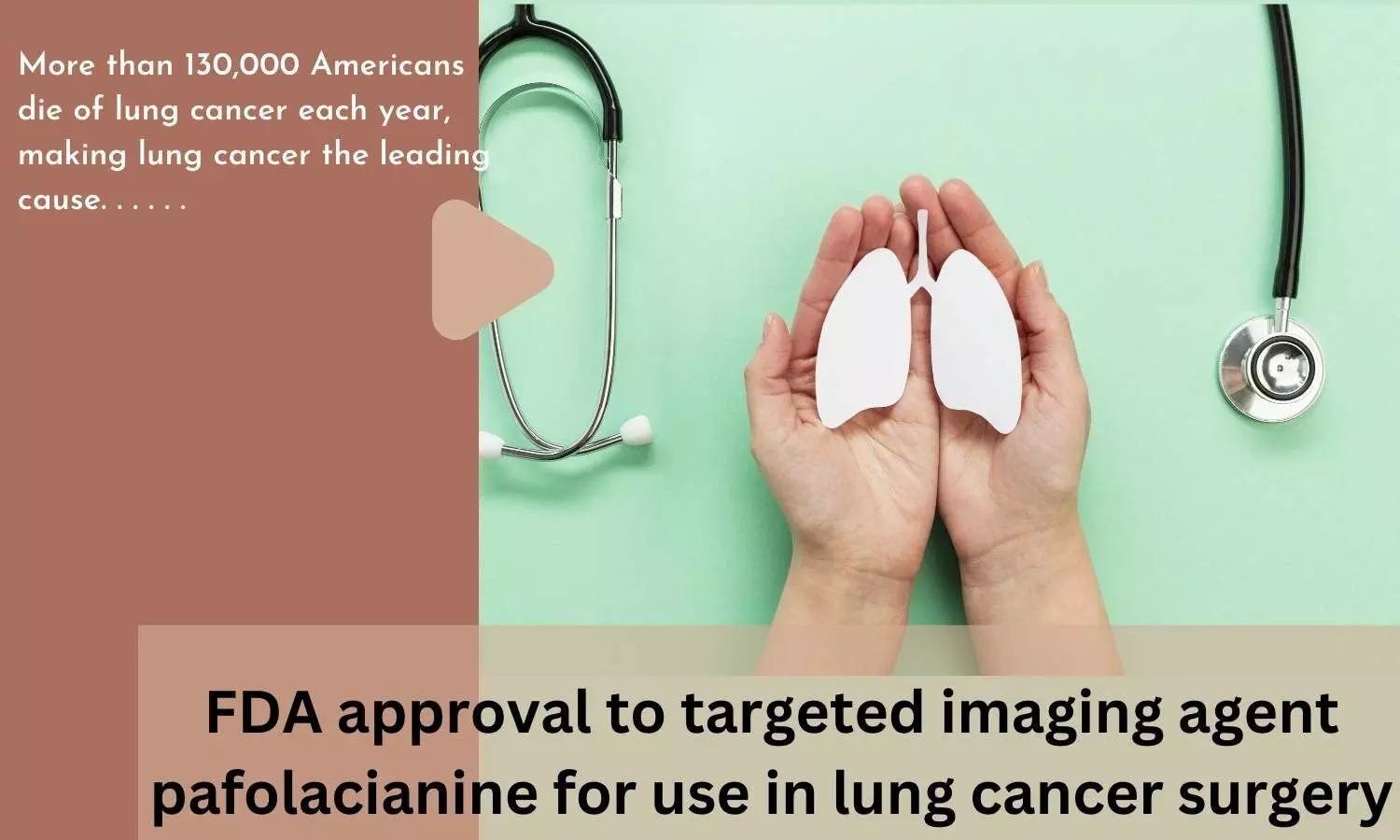 FDA approval to targeted imaging agent pafolacianine for use in lung cancer surgery