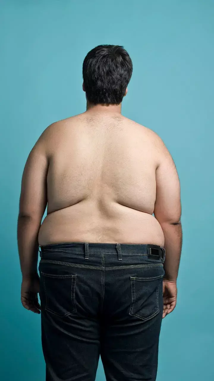 Keto Diet Improves Total Testosterone In Obese Non-Diabetic Males