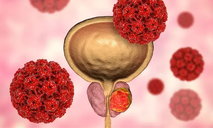 FDA Approves Gene Therapy for Treating High-Risk, Non-Muscle-Invasive Bladder Cancer