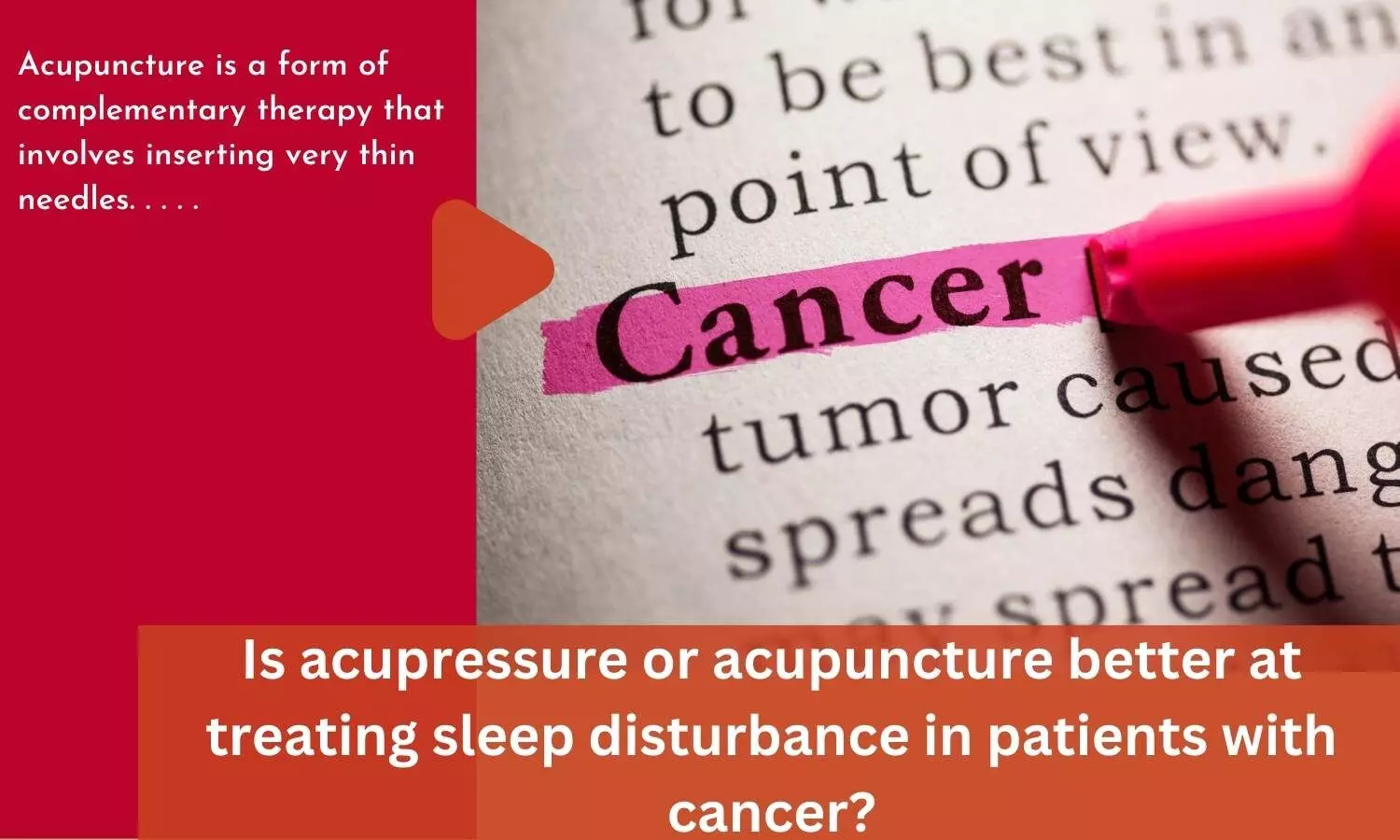 Is acupressure or acupuncture better at treating sleep disturbance in patients with cancer?