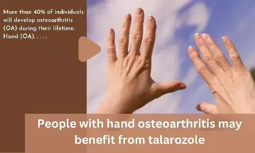People with hand osteoarthritis may benefit from talarozole