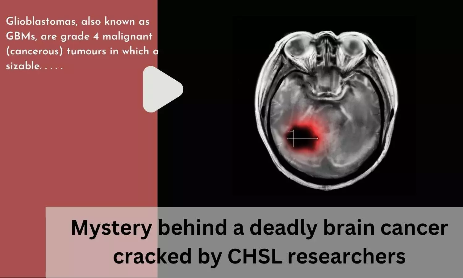 Mystery behind a deadly brain cancer cracked by CHSL researchers
