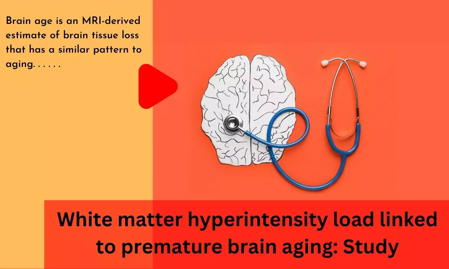 White matter hyperintensity load linked to premature brain aging: Study