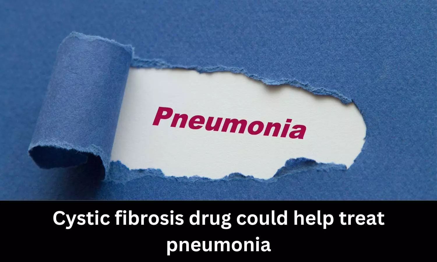Cystic fibrosis drug could help treat pneumonia