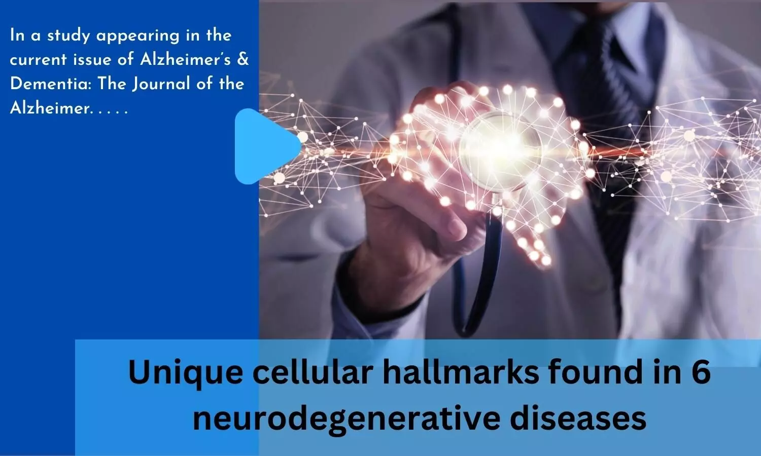 Unique cellular hallmarks found in 6 neurodegenerative diseases