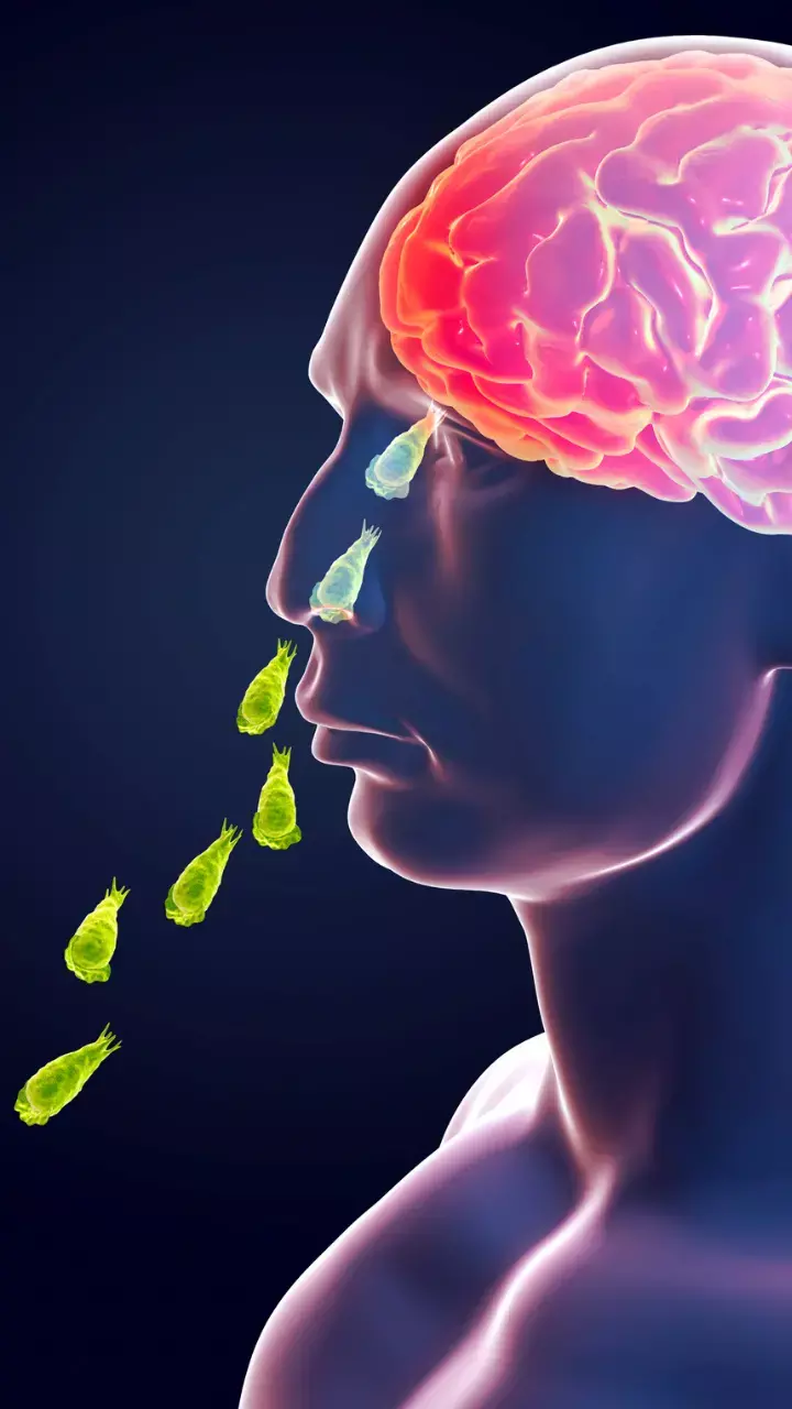 FIRST INFECTION DEATH FROM BRAIN-EATING AMOEBA