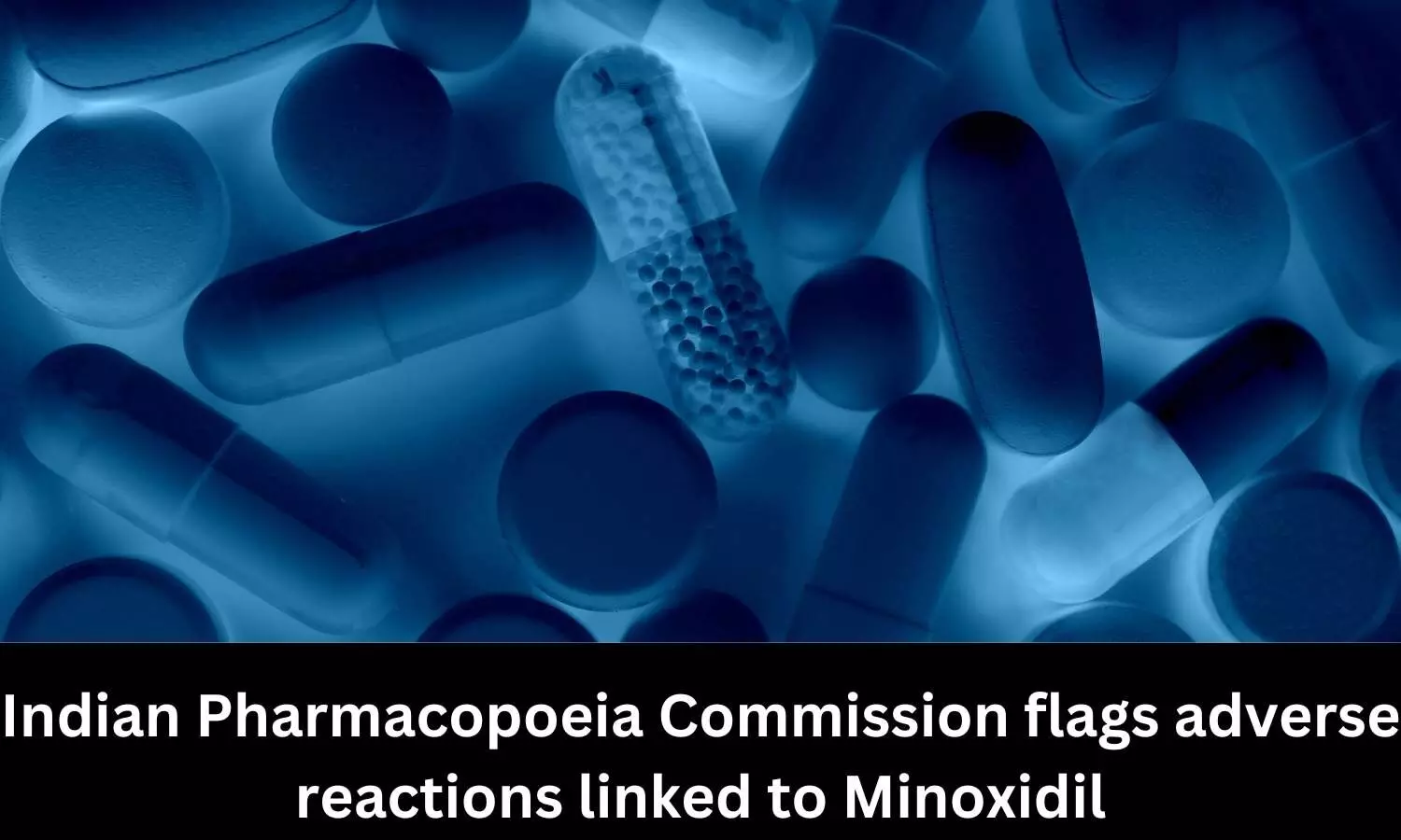 Minoxidil linked to folliculitis: Indian Pharmacopoeia Commission Drug Safety Alert