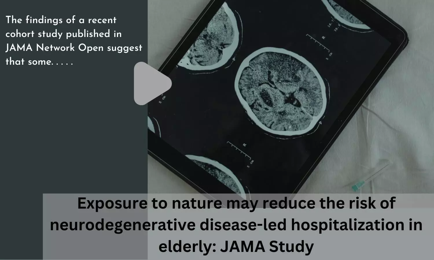 Exposure to nature may reduce the risk of neurodegenerative disease-led hospitalization in elderly: JAMA Study
