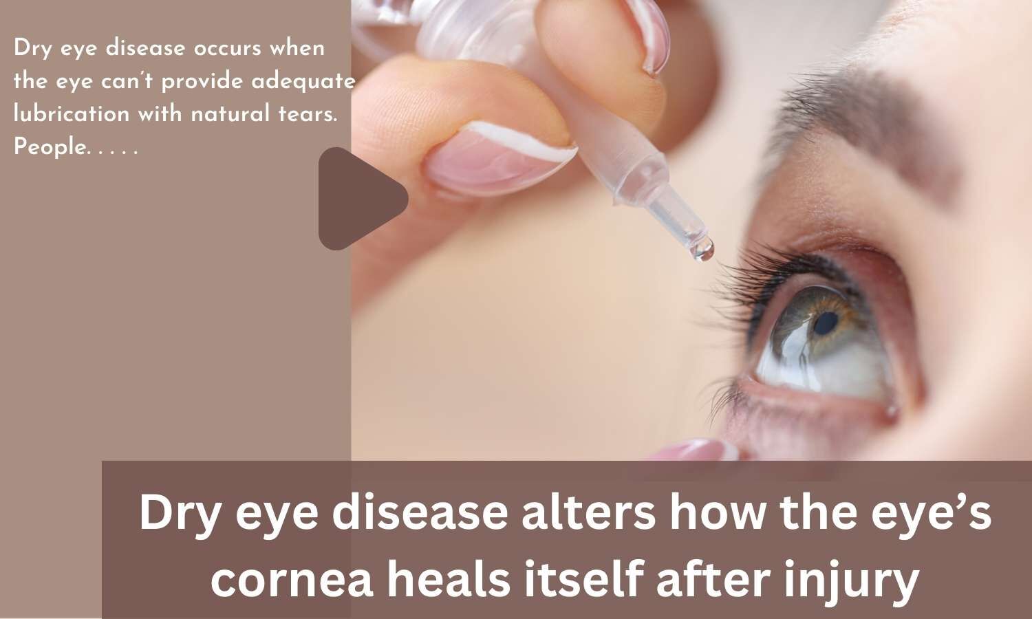 Dry eye disease alters how the eye's cornea heals itself after injury