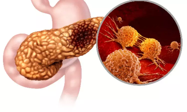 GLP-1 medications for type 2 diabetes and obesity may lower risk of acute pancreatitis: Study