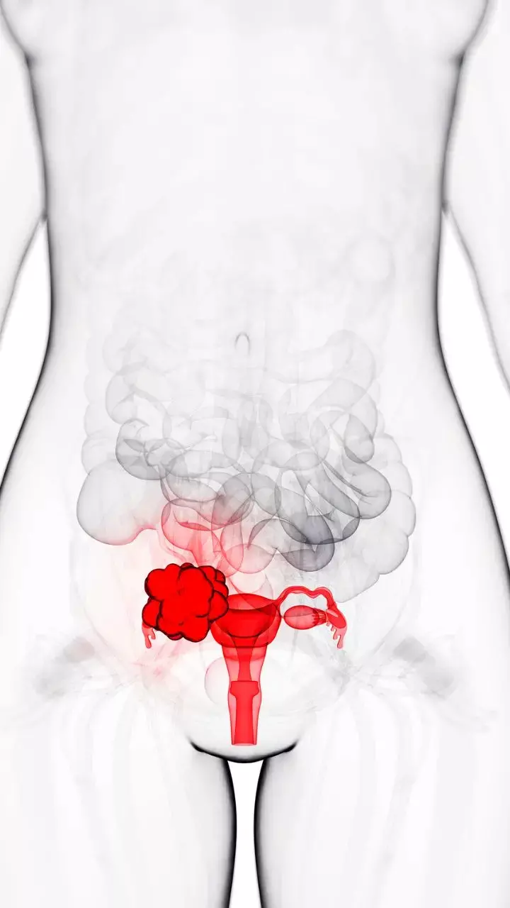 Cervical Cancer Awareness Month 2023