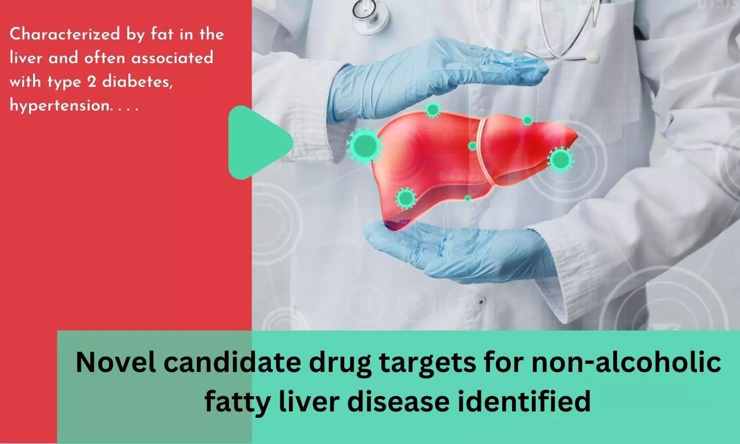 Novel candidate drug targets for non-alcoholic fatty liver disease identified