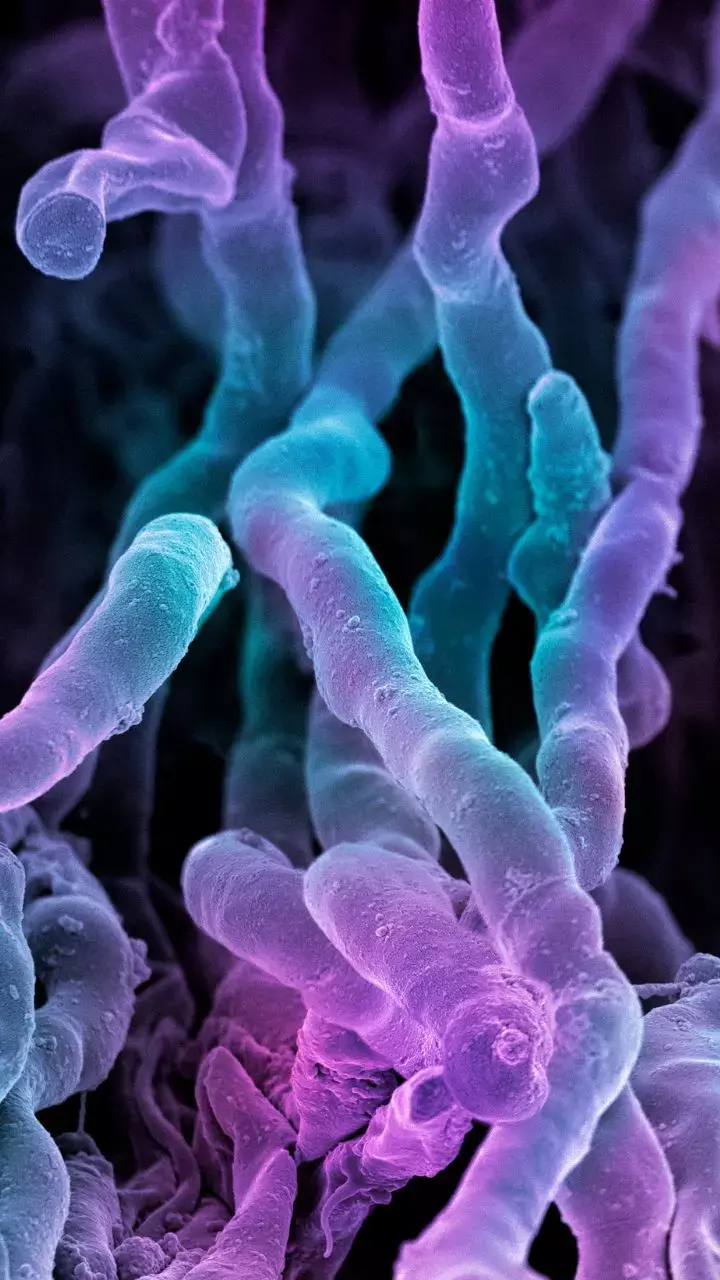 Gut Microbes Can Boost the Motivation to Exercise