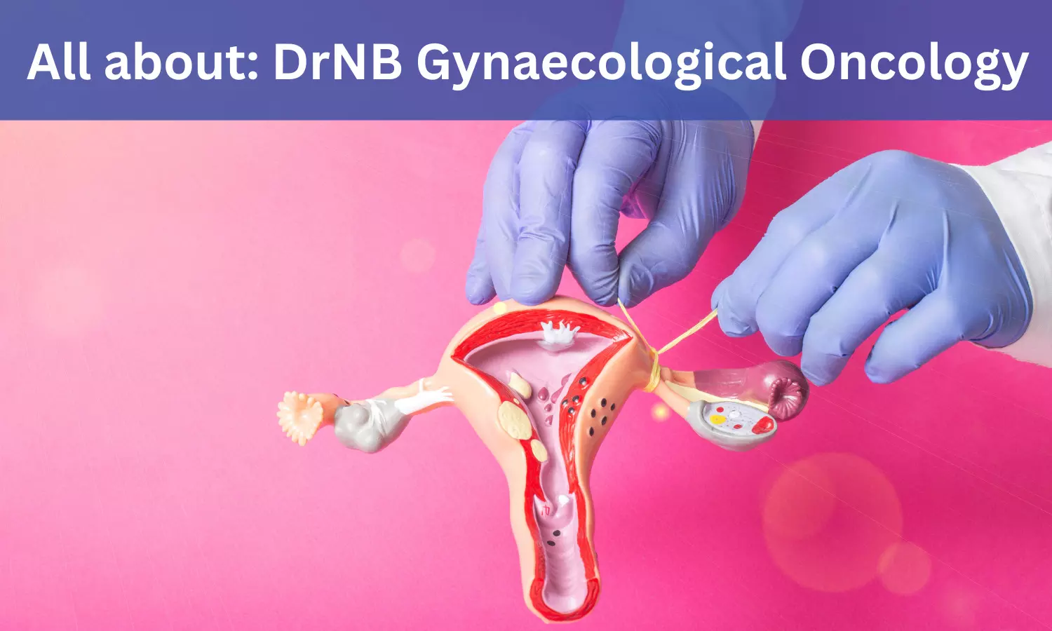DrNB Gynaecological Oncology: Admissions, Medical Colleges, Eligibility Criteria, fee details