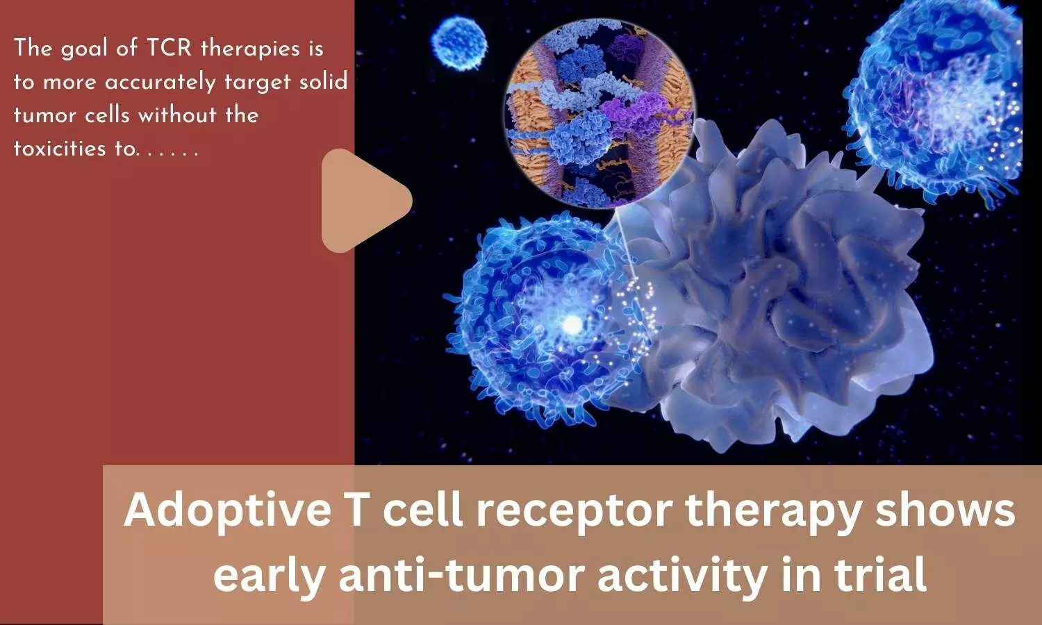 Adoptive T cell receptor therapy shows early anti-tumor activity in trial