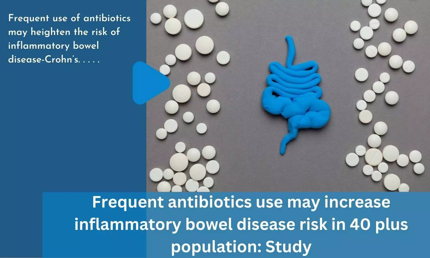 Frequent antibiotics use may increase inflammatory bowel disease risk in 40 plus population: Study