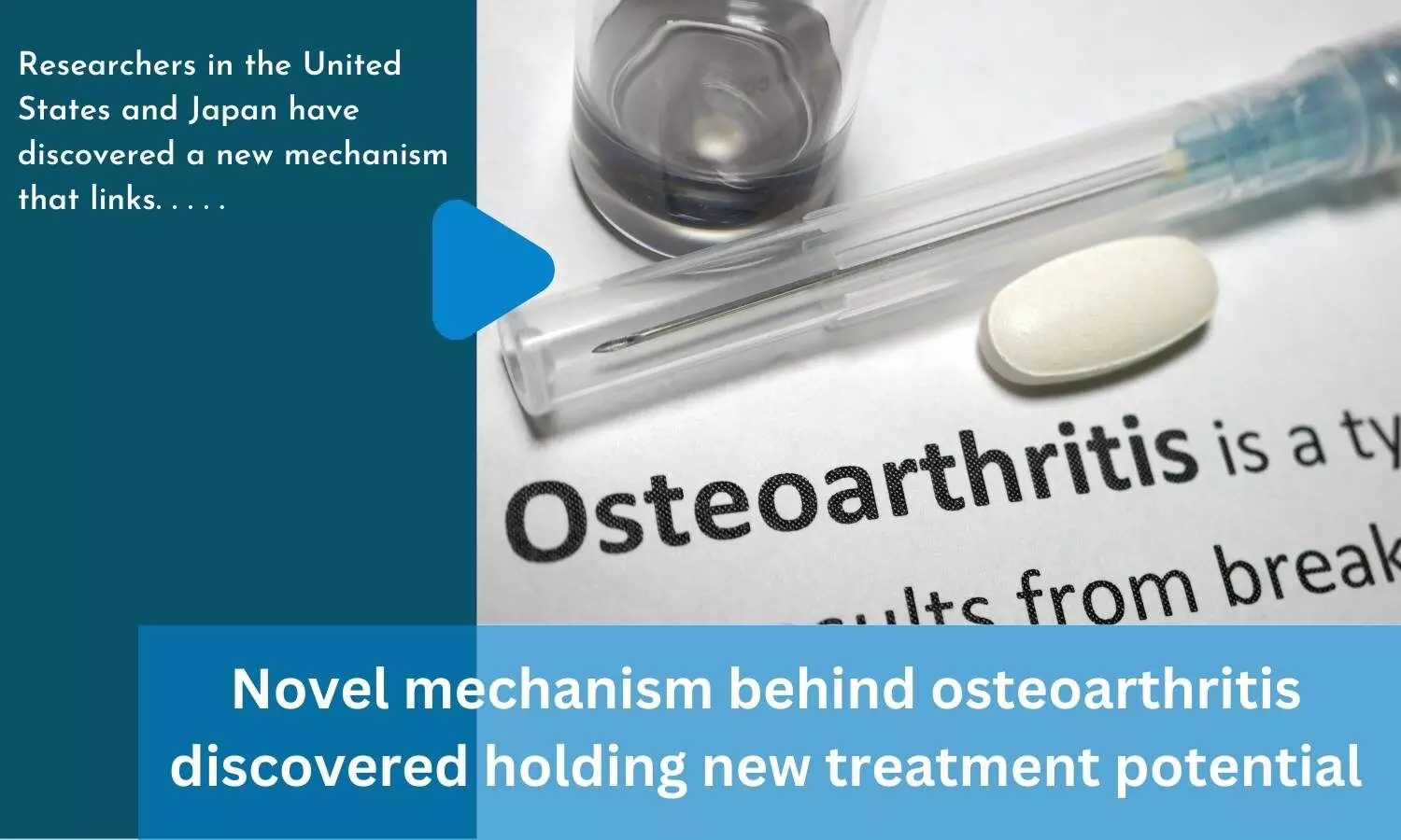 Novel mechanism behind osteoarthritis discovered holding new treatment potential