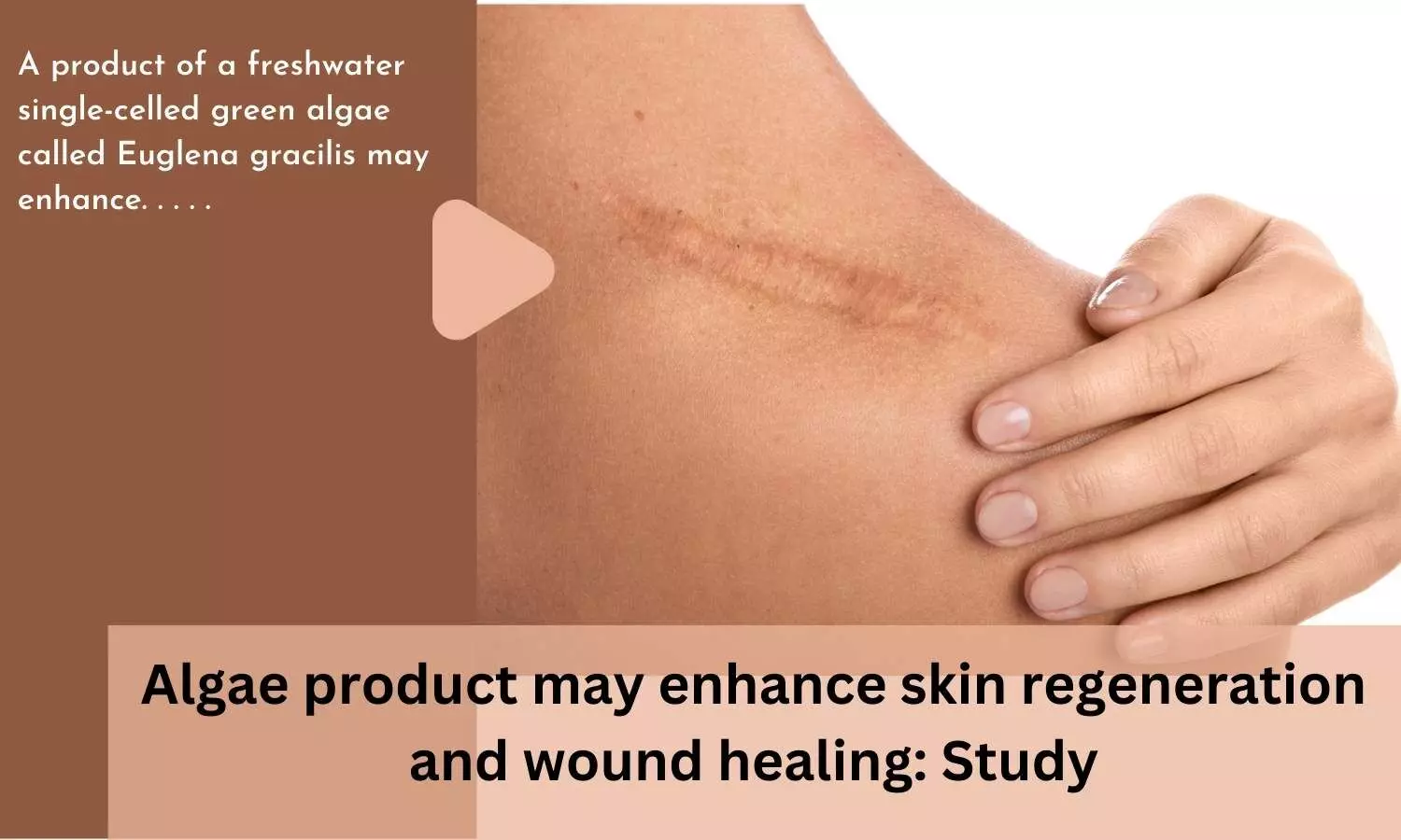 Algae product may enhance skin regeneration and wound healing: Study