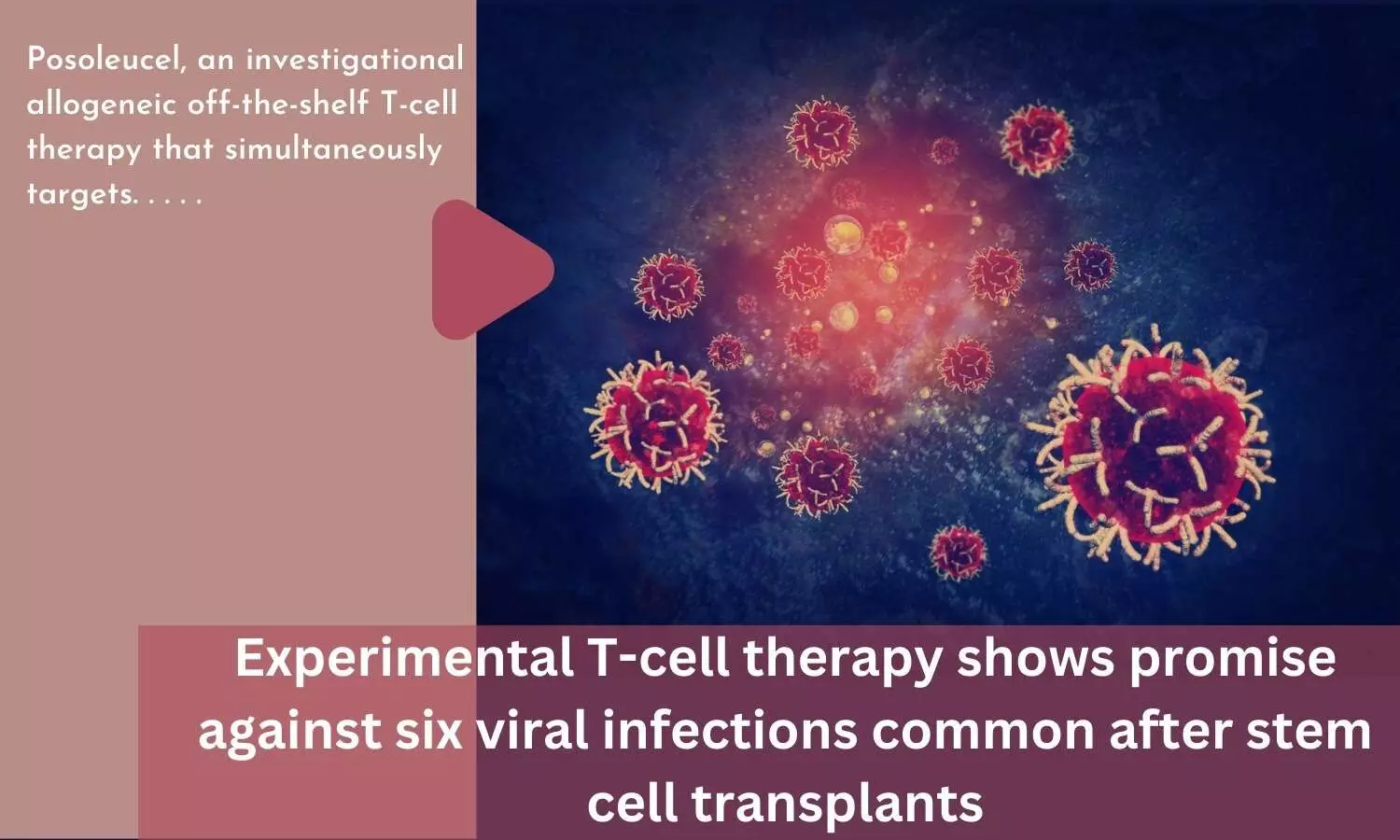 Experimental T-cell therapy shows promise against six viral infections common after stem cell transplants