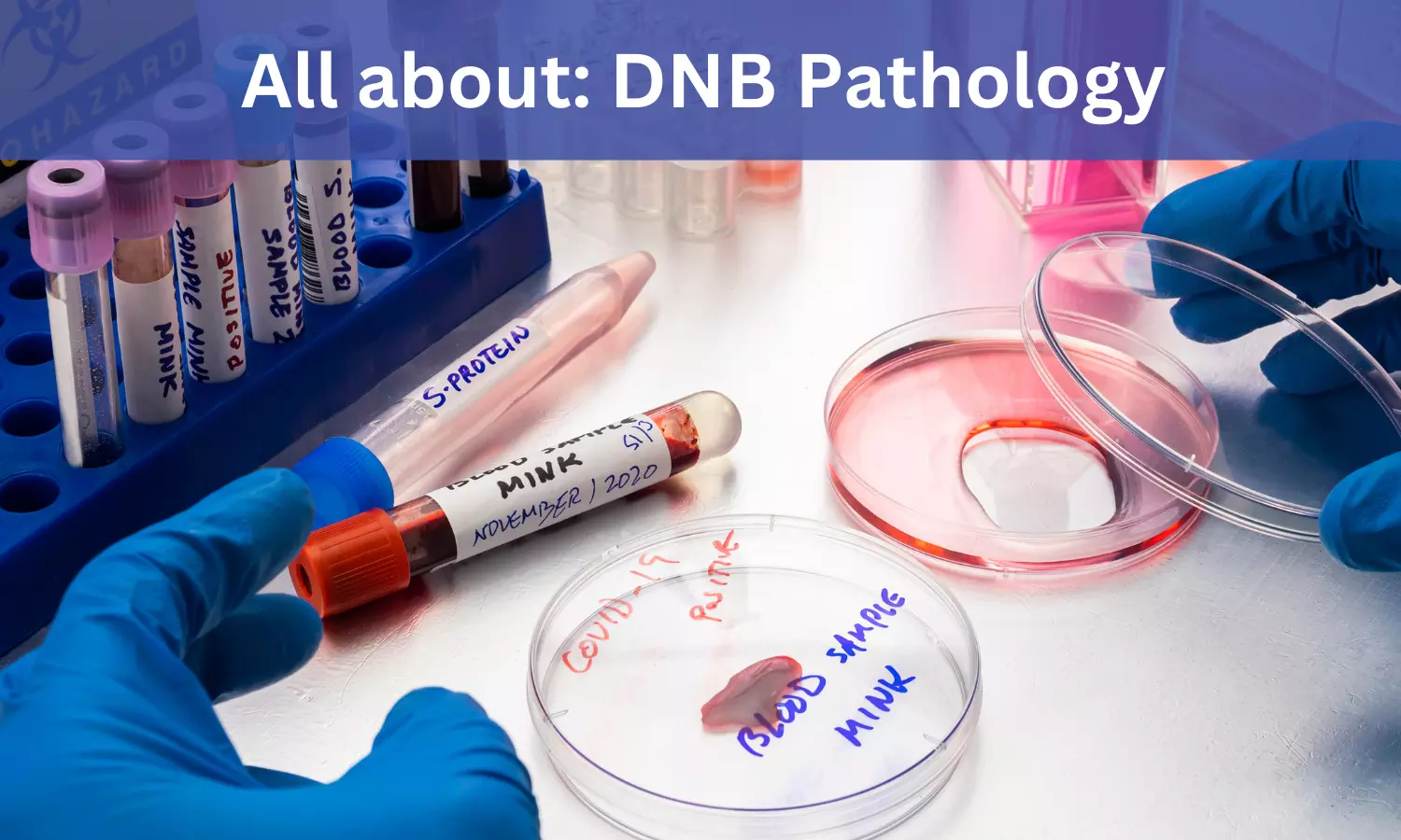 DNB Pathology: Admissions, Medical Colleges, Fee, Eligibility criteria details here
