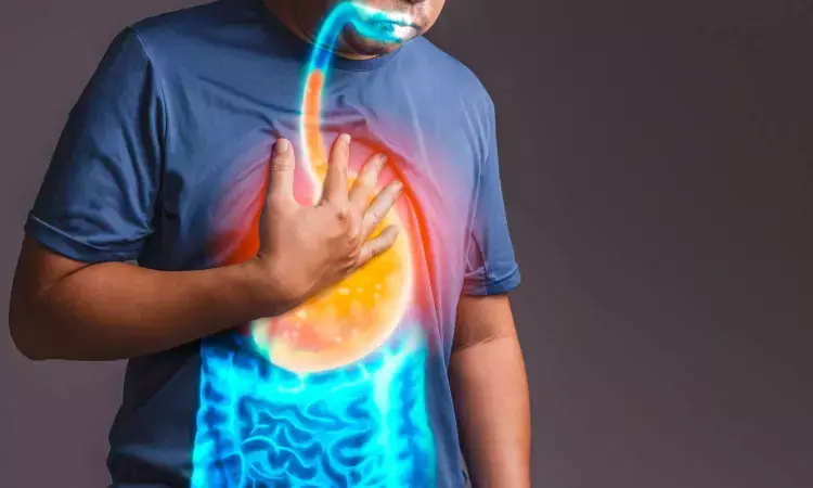 Vonoprazan significantly lowers heartburn symptoms in nonerosive GERD