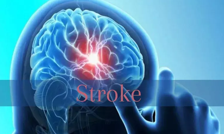 Patients of TIA need to be thoroughly investigated to prevent full blown stroke: AHA statement