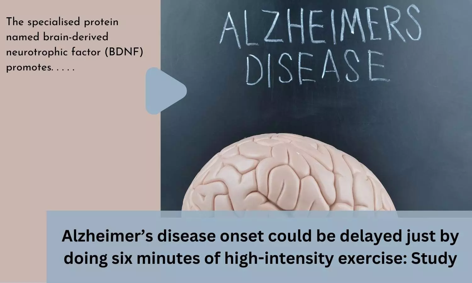 Alzheimers disease onset could be delayed just by doing six minutes of high-intensity exercise: Study