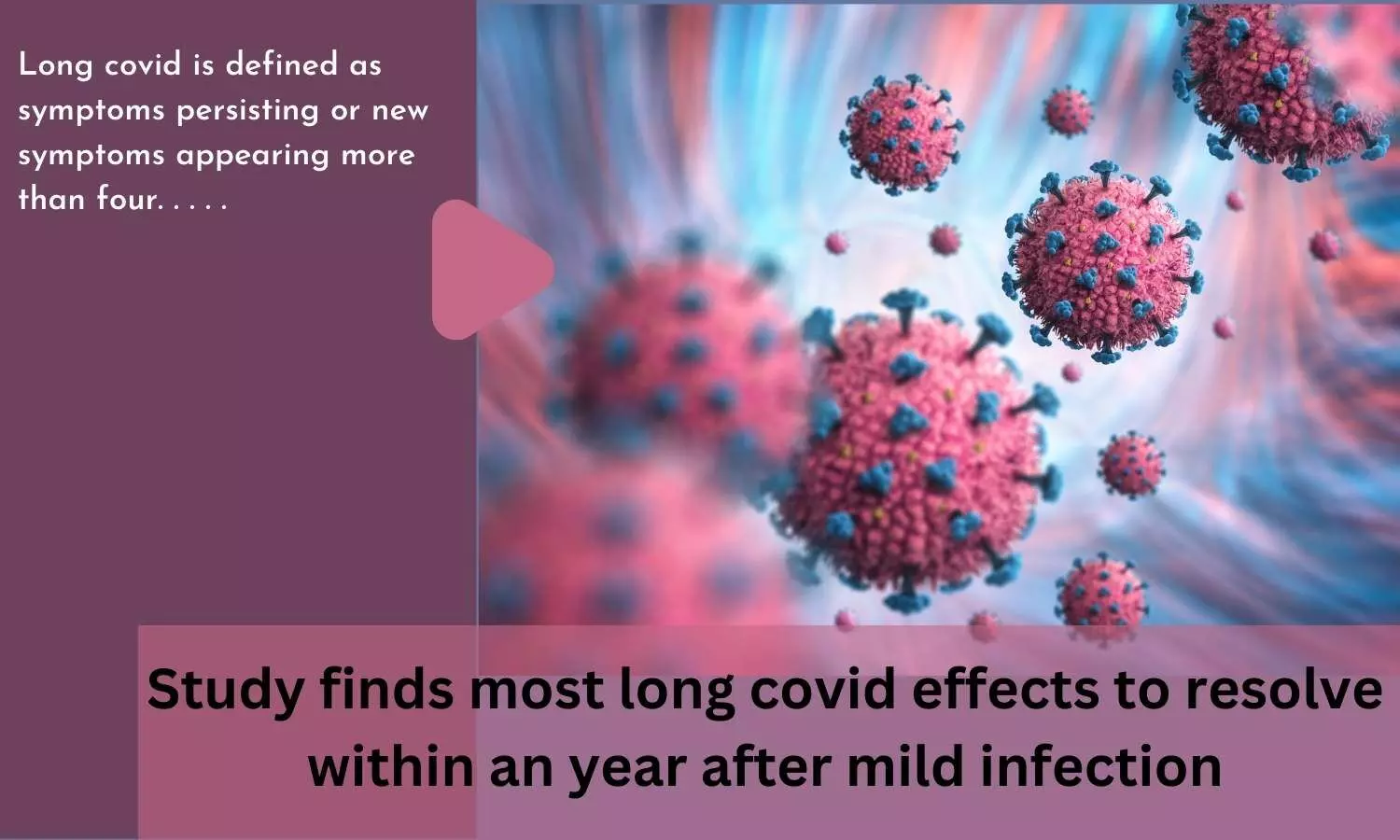 Study finds most long covid effects to resolve within an year after mild infection