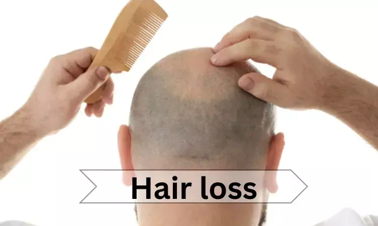 Long-term therapy Baricitinib improves hair growth in severe alopecia areata